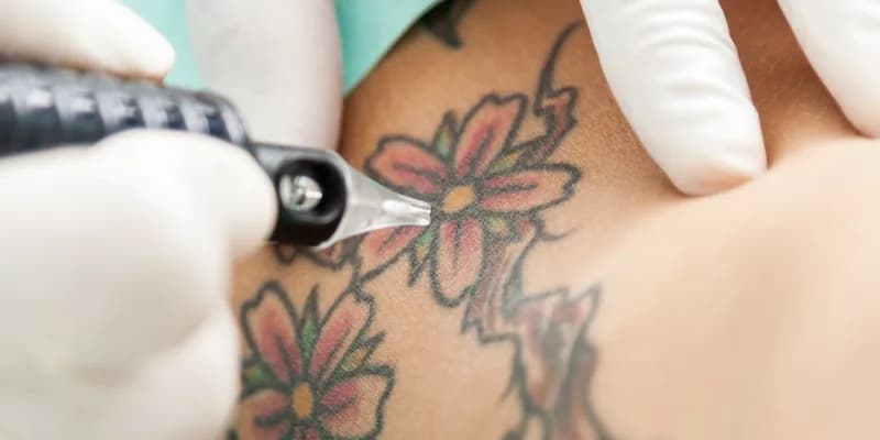 Objawy po tatuażu: Co może oznaczać ból, obrzęk i alergie?